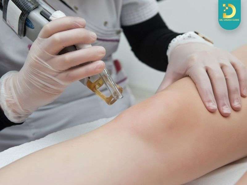 Top Cách Trị Thâm Đầu Gối, Khuỷu Tay, Mắt Cá Hiệu Quả Tại Nhà 20 Thâm liên quan đến bệnh lý hoặc cần can thiệp y khoa