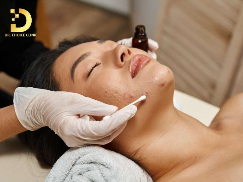 Mụn Không Viêm: Phân Loại, Nguyên Nhân & Cách Điều Trị 12 Làm thế nào để điều trị mụn không viêm hiệu quả?
