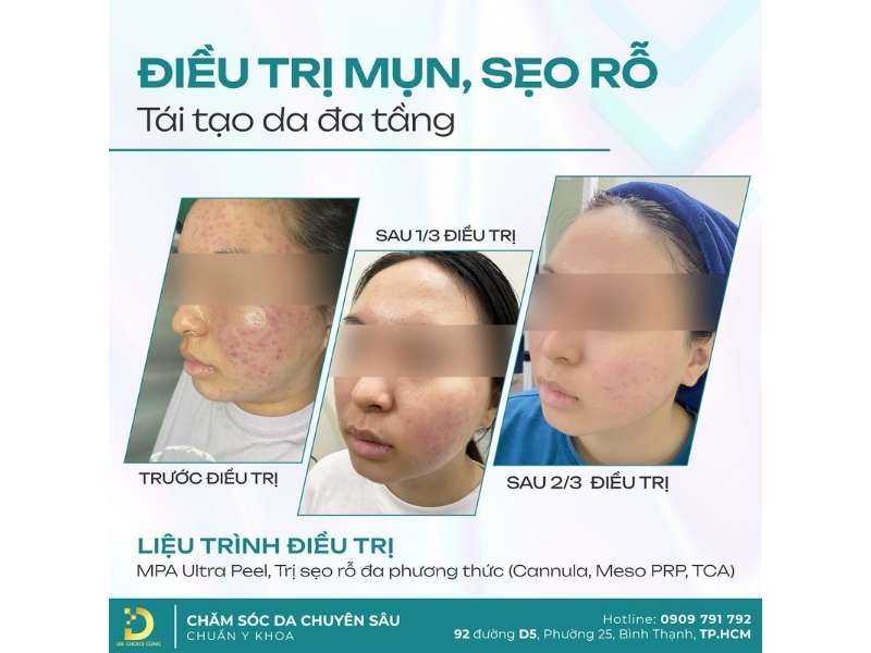 Da Nhạy Cảm Là Gì? Các Vấn Đề Thường Gặp & Cách Khắc Phục 15 Đơn vị nào chuyên khám và điều trị các vấn đề liên quan đến da nhạy cảm hiệu quả và an toàn tại HCM?