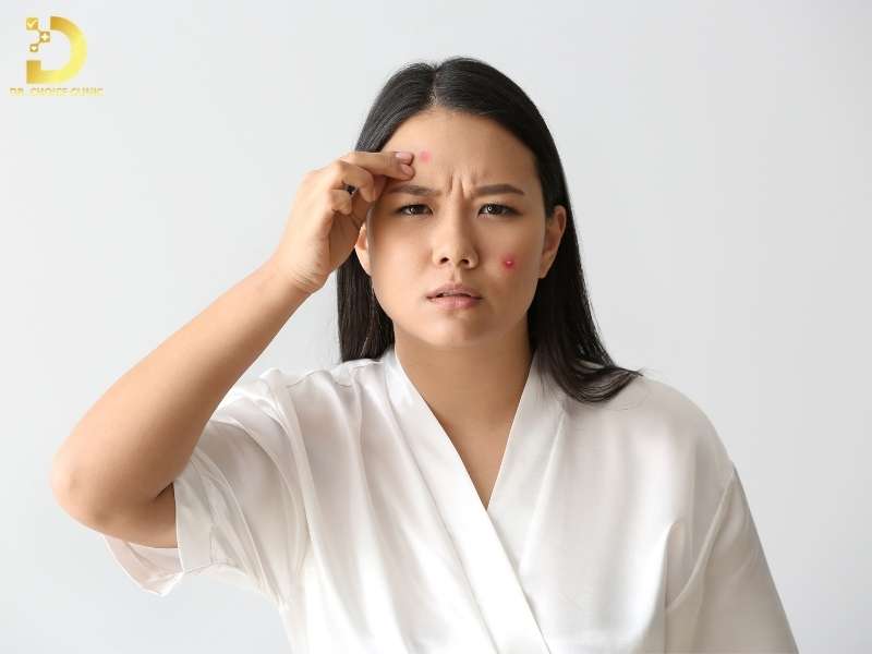 Skincare Cho Da Mụn: Chu Trình Chuẩn & Lưu Ý Sử Dụng Mỹ Phẩm 15 Lưu ý gì khi sử dụng mỹ phẩm cho da mụn?