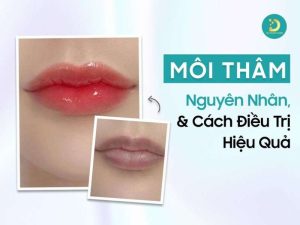 Môi thâm