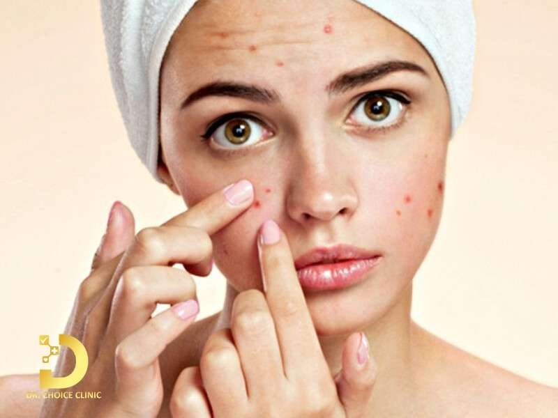 Mụn Viêm Đỏ Có Nên Nặn Không? Cách Điều Trị Tại Nhà Hiệu Quả 10 Mụn viêm đỏ là gì?