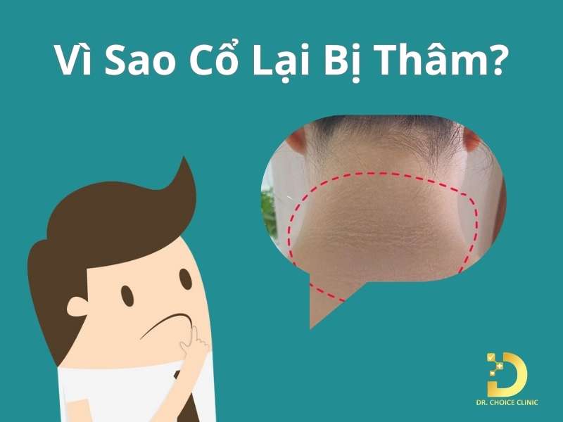 Thâm Cổ: Nguyên Nhân & Cách Điều Trị Nhanh, Hiệu Quả Nhất 10 Nguyên nhân nào dẫn đến tình trạng thâm cổ?