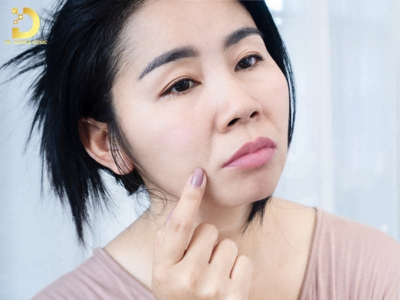 Rãnh Cười Là Gì? Nguyên Nhân & Cách Làm Đầy Hiệu Quả 11 Nguyên nhân và tiến triển của rãnh cười theo thời gian