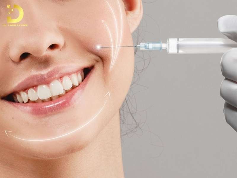 Rãnh Cười Là Gì? Nguyên Nhân & Cách Làm Đầy Hiệu Quả 12 Phương pháp làm đầy rãnh cười nào hiệu quả?