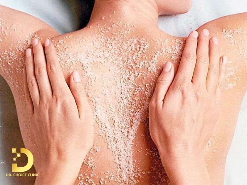TOP 11 Cách Trị Mụn Lưng Tại Nhà Nhanh, Hiệu Quả 9 Tẩy tế bào chết định kỳ để ngăn bít tắc nang lông