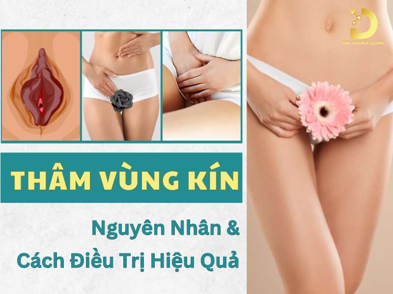 Thâm Vùng Kín: Nguyên Nhân & Cách Điều Trị Hiệu Quả 8 Thâm vùng kín