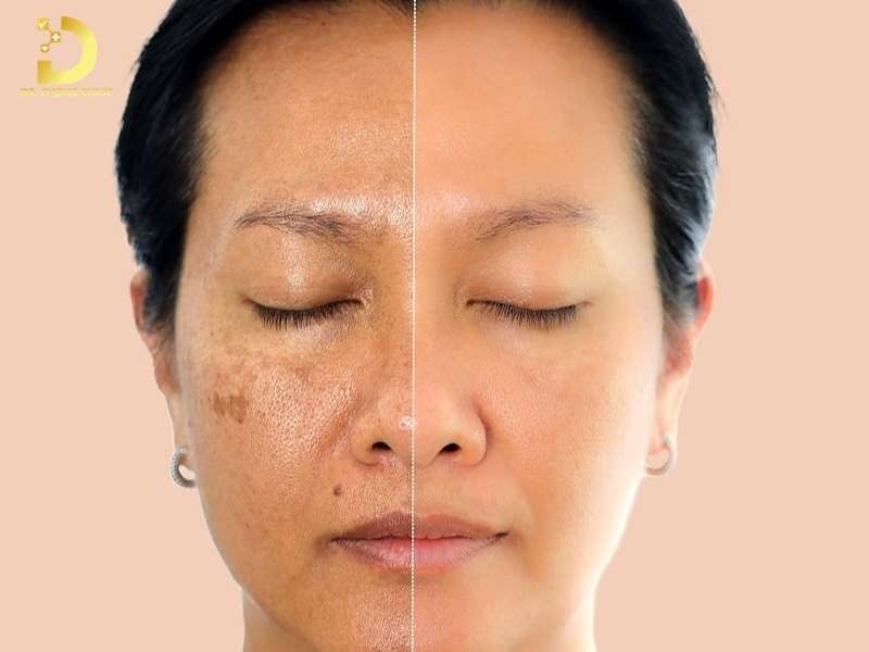 Top 7 Thành Phần Chống Lão Hóa Được Chuyên Gia Khuyên Dùng 11 Vì sao da cần treatment từ sau tuổi 25? cơ chế và nhóm hoạt chất chính