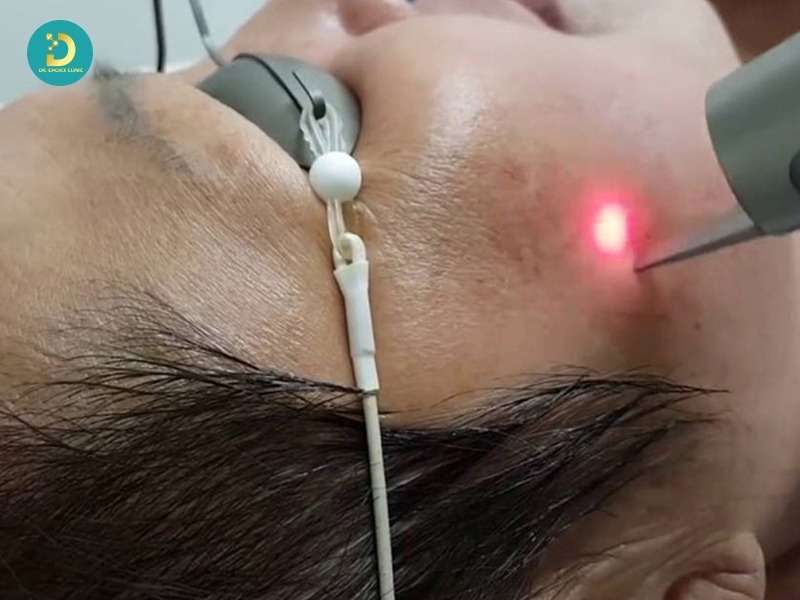 Phân Biệt Nám Da, Tàn Nhang, Đồi Mồi Như Thế Nào? 18 Các phương pháp thường được áp dụng trong điều trị nám da, tàn nhang, đồi mồi
