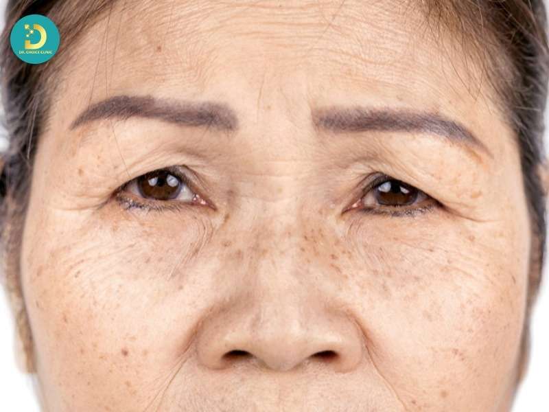 Cẩm Nang Chăm Sóc Da Toàn Diện Cho Tuổi Trung Niên 13 Các vấn đề da phổ biến nhất ở tuổi trung niên và nguyên nhân gốc rễ