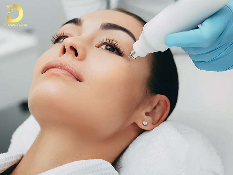 Top Cách Xóa Nhăn Vùng Da Quanh Mắt Hiệu Quả Tại Nhà 19 Công nghệ laser tái tạo bề mặt da