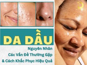 Da dầu