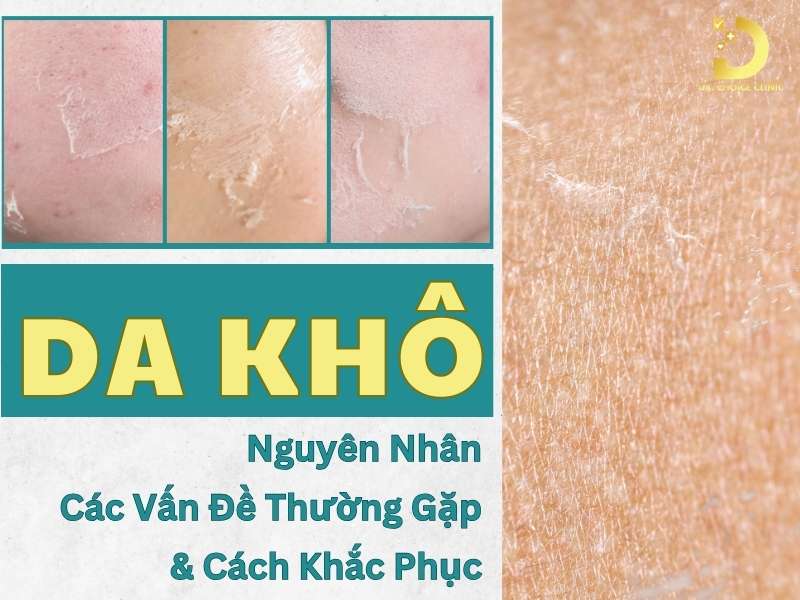 Da Khô: Nguyên Nhân, Các Vấn Đề Thường Gặp & Cách Khắc Phục 7 Da khô