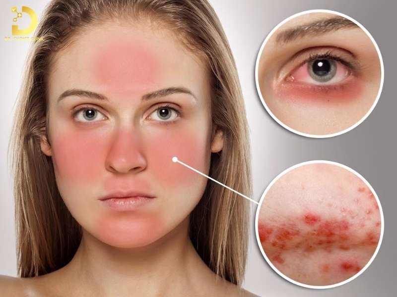 Da Nhạy Cảm Là Gì? Các Vấn Đề Thường Gặp & Cách Khắc Phục 10 Da nhạy cảm là da gì?