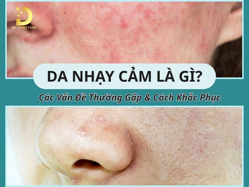Da Nhạy Cảm Là Gì? Các Vấn Đề Thường Gặp & Cách Khắc Phục 9 Da nhạy cảm là gì?