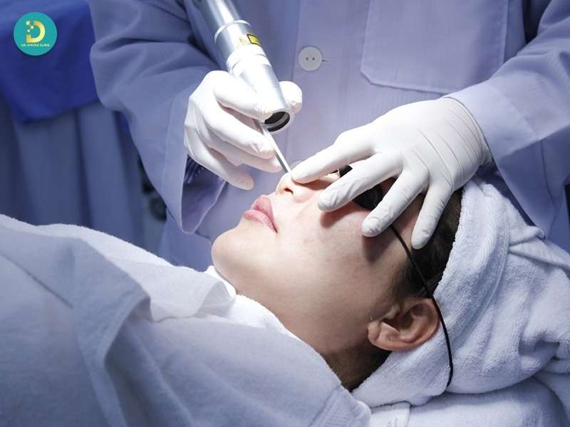 Rối Loạn Sắc Tố Da: Nguyên Nhân, Các Loại & Cách Điều Trị Hiệu Quả 19 Điều trị rối loạn sắc tố da bằng công nghệ y khoa (tại Clinic/Bệnh viện)
