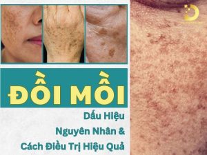 Đồi mồi