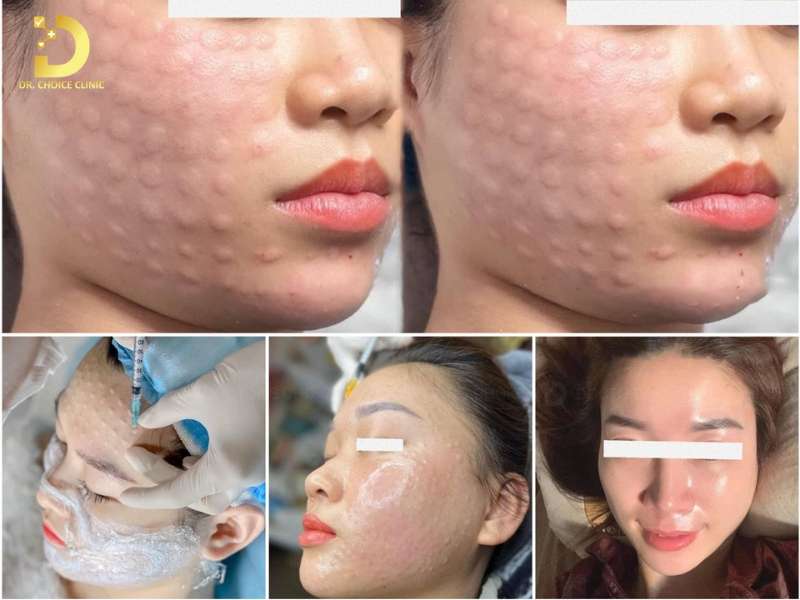 Massage Mặt Chống Lão Hóa: Lợi Ích & Top Phương Pháp Hiệu Quả 17 Đơn vị nào cung cấp dịch vụ trẻ hóa da mặt chuyên nghiệp, uy tín tại Hồ Chí Minh?