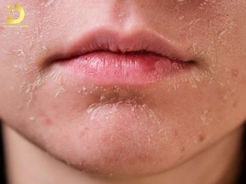 Da Khô: Nguyên Nhân, Các Vấn Đề Thường Gặp & Cách Khắc Phục 8 Hiểu đúng về da khô