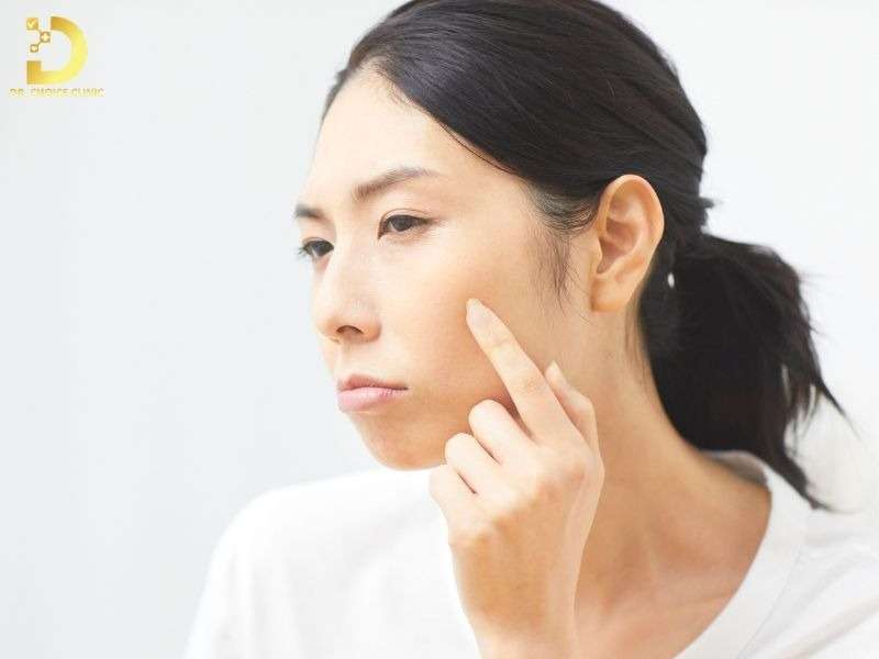 Nám Da: Nguyên Nhân, Phân Loại & Cách Điều Trị 12 Lưu ý gì khi chăm sóc da nám tại nhà để ngăn ngừa tái phát?