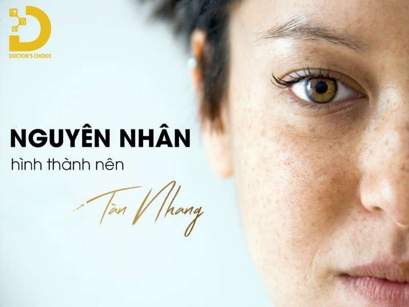 Tàn Nhang: Dấu Hiệu, Nguyên Nhân & Cách Điều Trị Hiệu Quả 15 Nguyên nhân nào kích thích sự hình thành các đốm tàn nhang?