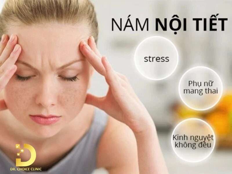 Nám Nội Tiết Là Gì? Nguyên Nhân, Cách Điều Trị & Phòng Ngừa 12 Những nguyên nhân cốt lõi nào kích hoạt sự xuất hiện của nám nội tiết?
