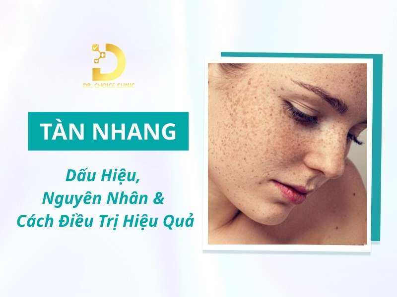 Tàn Nhang: Dấu Hiệu, Nguyên Nhân & Cách Điều Trị Hiệu Quả 11 Tàn nhang