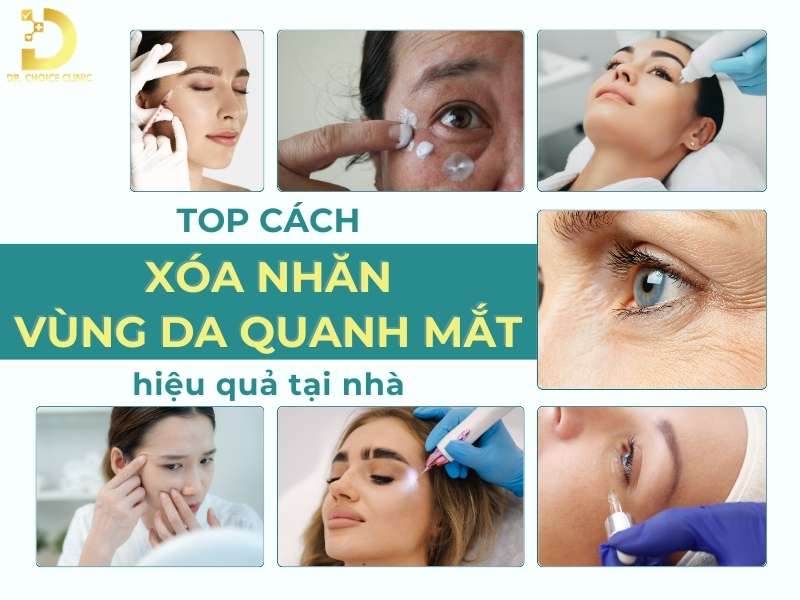 Top Cách Xóa Nhăn Vùng Da Quanh Mắt Hiệu Quả Tại Nhà 12 Cách xóa nhăn vùng da quanh mắt hiệu quả