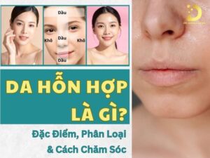 Da hỗn hợp là gì?