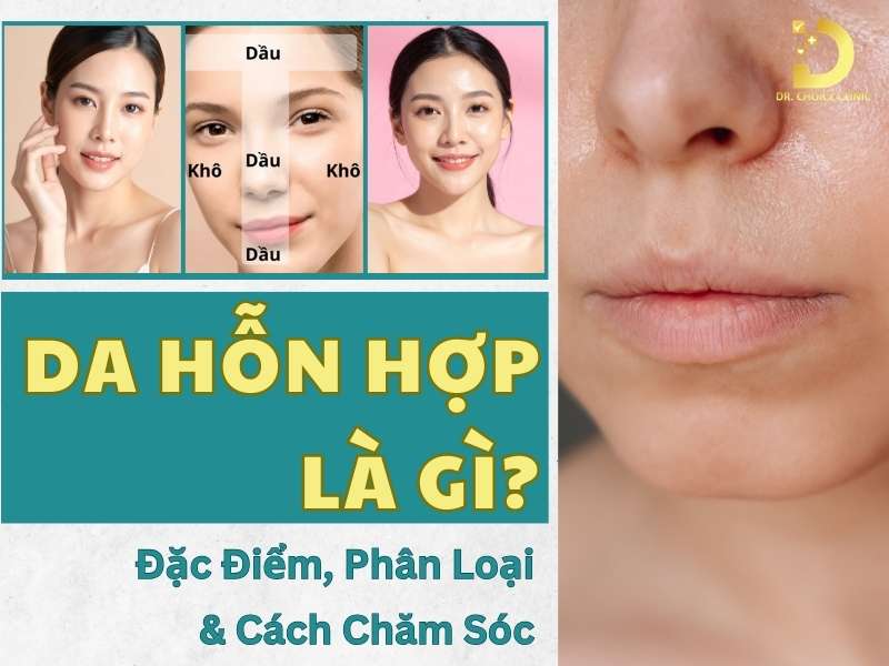 Da Hỗn Hợp Là Gì? Đặc Điểm, Phân Loại & Cách Chăm Sóc 9 Da hỗn hợp là gì?