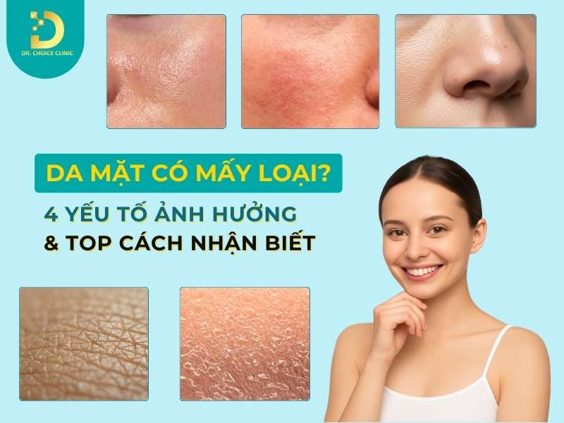 Da Mặt Có Mấy Loại? Yếu Tố Ảnh Hưởng Và Cách Nhận Biết 8 Da mặt có mấy loại?