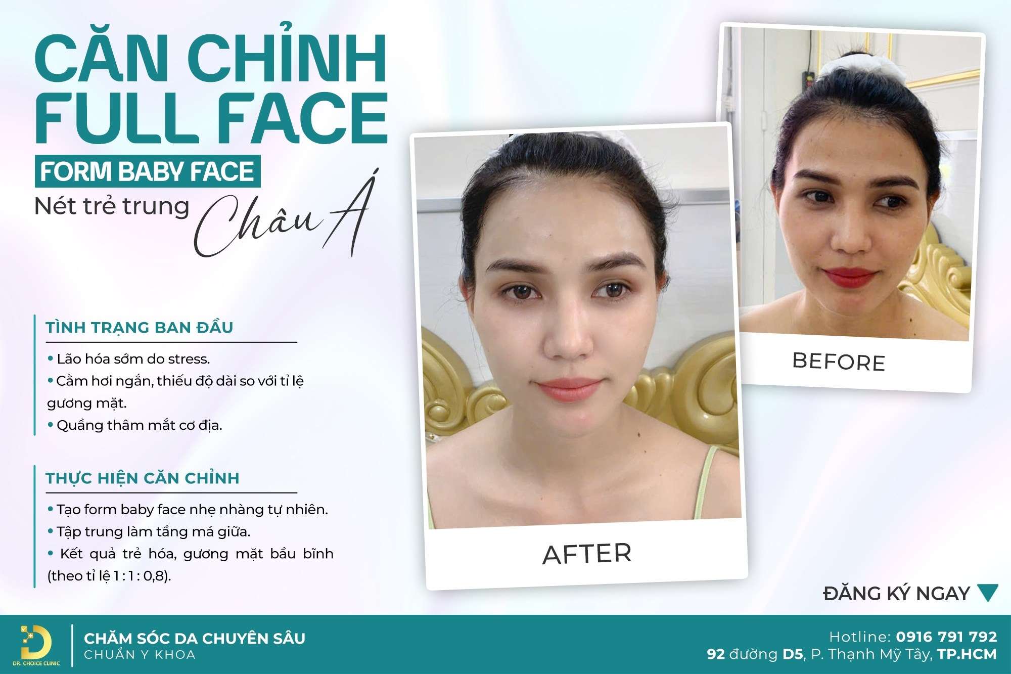 Review Top Công Nghệ Trẻ Hóa Da Tiên Tiến, Hiệu Quả Nhất 20 Địa chỉ nào trẻ hóa da bằng công nghệ tiên tiến, hiệu quả nhất HCM?