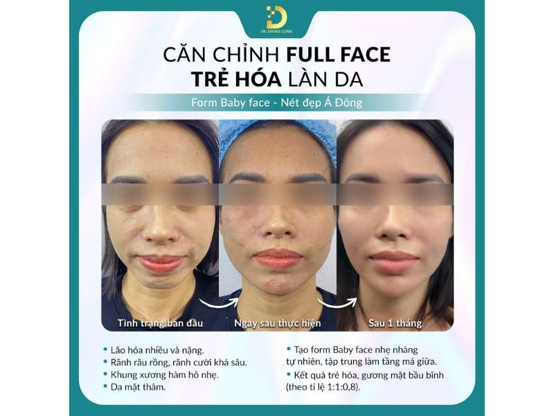 Review Top Công Nghệ Trẻ Hóa Da Tiên Tiến, Hiệu Quả Nhất 21 Địa chỉ nào trẻ hóa da bằng công nghệ tiên tiến, hiệu quả nhất HCM?
