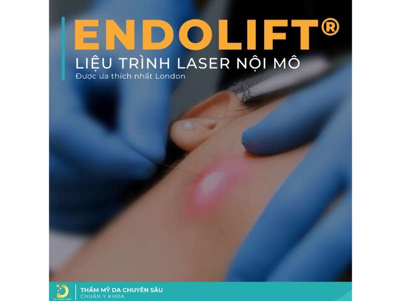 Review Top Công Nghệ Trẻ Hóa Da Tiên Tiến, Hiệu Quả Nhất 16 Laser nội mô Endolift