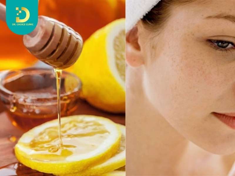Top Mặt Nạ Trị Thâm Tại Nhà Hiệu Quả Bạn Không Nên Bỏ Qua 10 Mặt nạ chanh và mật ong