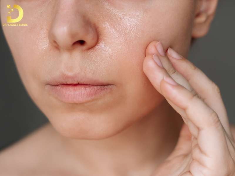 Da Hỗn Hợp Là Gì? Đặc Điểm, Phân Loại & Cách Chăm Sóc 15 Sai lầm phổ biến khi chăm sóc da hỗn hợp