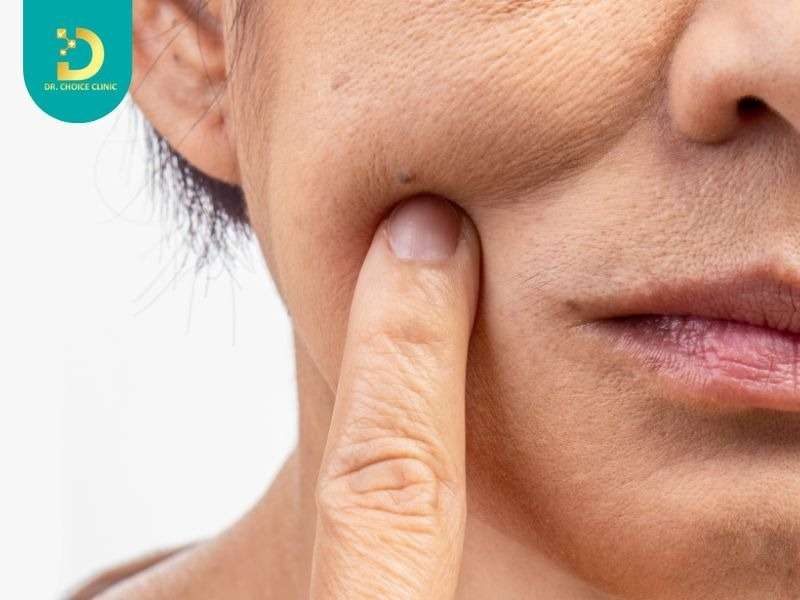 Mỹ Phẩm Cho Da Lão Hóa: 5 Tiêu Chí Lựa Chọn & Top Sản Phẩm Chuyên Gia Khuyên Dùng 12 Sự phù hợp với loại da: Phân biệt giữa da lão hóa dầu và da lão hóa khô