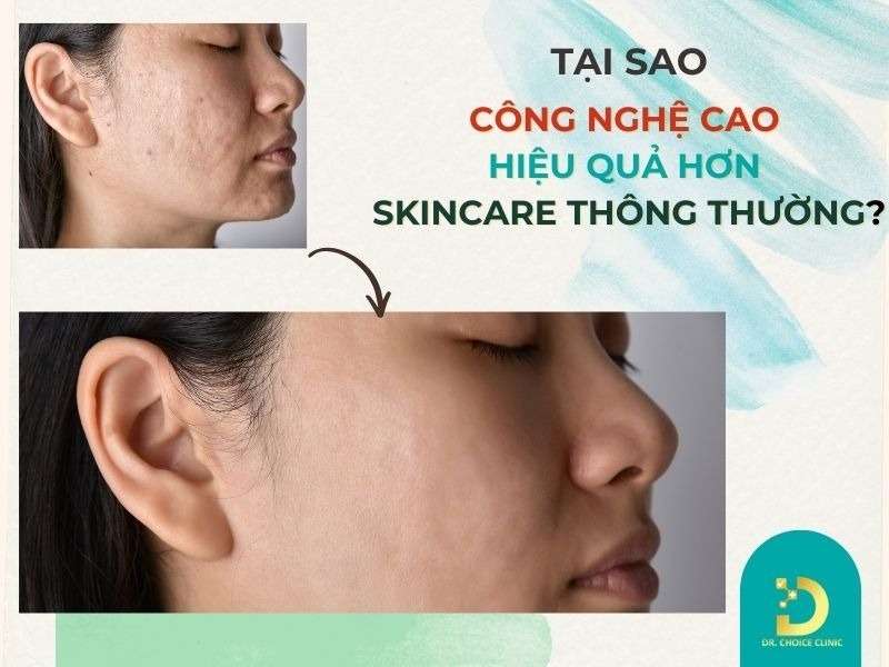 Review Top Công Nghệ Trẻ Hóa Da Tiên Tiến, Hiệu Quả Nhất 13 Tại sao công nghệ cao hiệu quả hơn skincare thông thường?