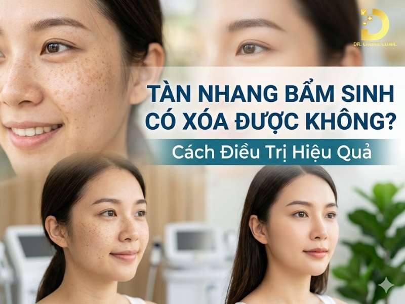 Tàn Nhang Bẩm Sinh Là Gì? Dấu Hiệu, Nguyên Nhân & Cách Điều Trị 12 Tàn nhang bẩm sinh là gì?