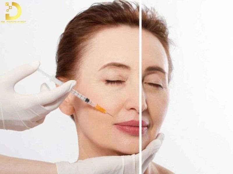 Tiêm Filler Và Botox Khác Nhau Như Thế Nào? Lưu Ý Lựa Chọn 14 Tiêm filler và botox khác nhau như thế nào?