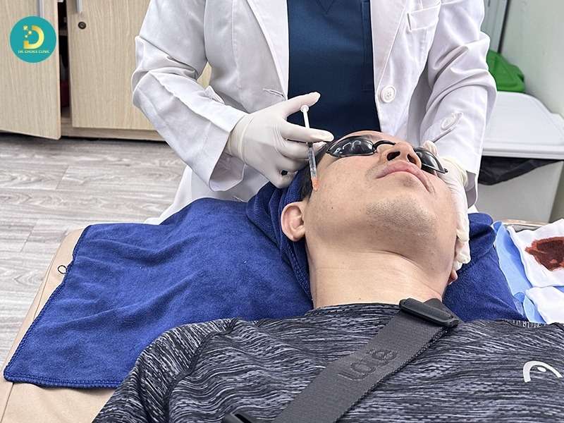 Phòng Khám Phục Hồi Da Mỏng Yếu, Đỏ, Giãn Mạch Uy Tín TP. HCM 14 Nhóm meso phục hồi chuyên sâu (đi vào trung bì)