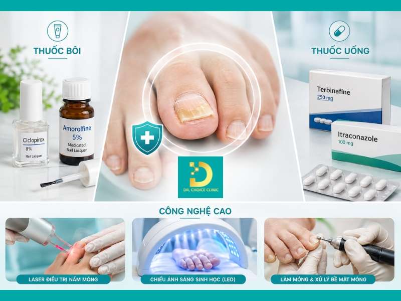 Phòng Khám Chữa Nấm Móng Uy Tín Hiệu Quả HCM 10 Phòng khám chữa nấm móng