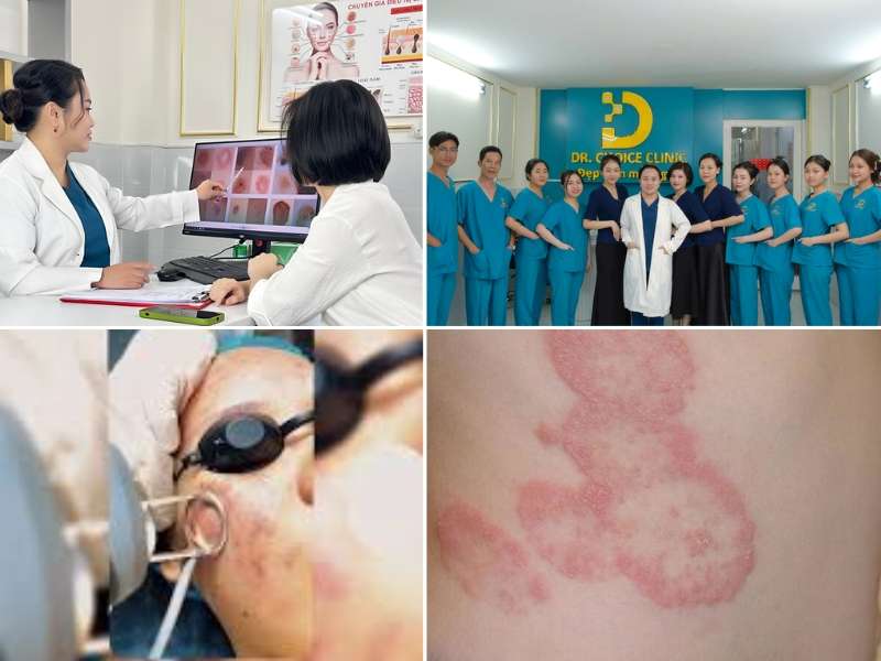 Phòng Khám Điều Trị Nấm Thân Mình Uy Tín, Hiệu Quả HCM 11 Địa chỉ nào điều trị nấm thân mình uy tín, hiệu quả tại HCM?