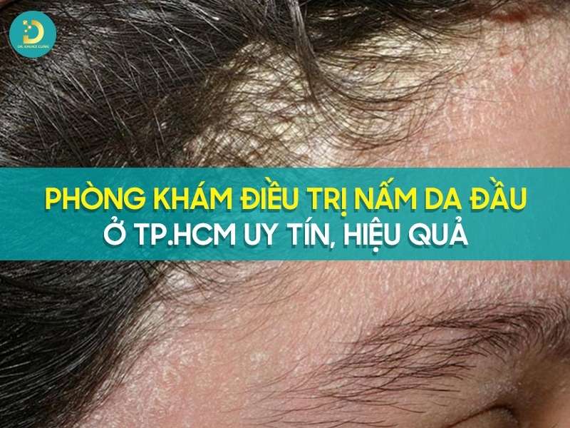 Phòng Khám Điều Trị Nấm Da Đầu Ở TP.HCM Uy Tín, Hiệu Quả 9 Phòng khám điều trị nấm da đầu ở tp.HCM uy tín