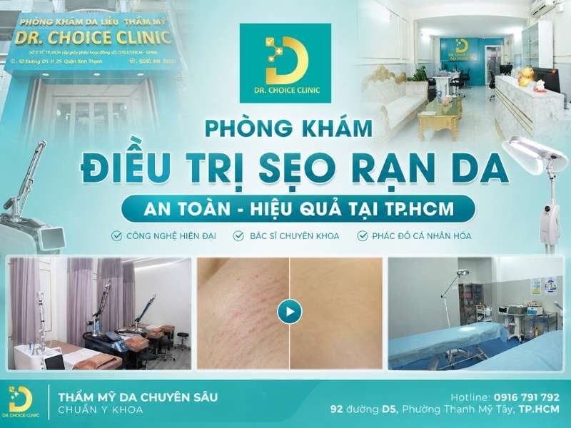 Phòng Khám Điều Trị Sẹo Rạn Da An Toàn, Hiệu Quả Tại TP.HCM 8 Phòng khám điều trị sẹo rạn da an toàn