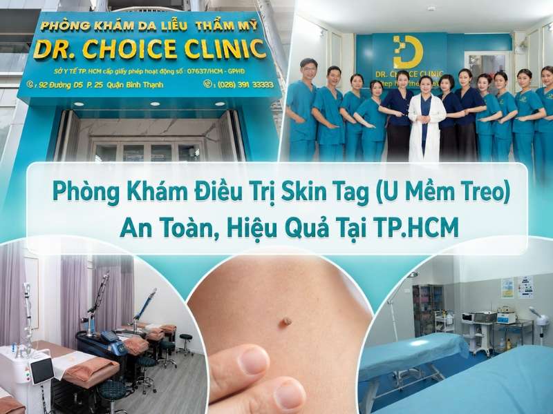Phòng Khám Điều Trị Skin Tag (U Mềm Treo) An Toàn, Hiệu Quả Tại TP.HCM 8 Phòng Khám Điều Trị Skin Tag (U Mềm Treo) An Toàn, Hiệu Quả Tại TP.HCM