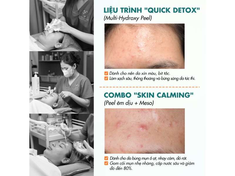 Phòng Khám Tái Tạo Da Căng Bóng & Phục Hồi Hiệu Quả Tại TP.HCM 22 phòng khám dr. choice clinic mang đến giải pháp tái tạo da căng bóng