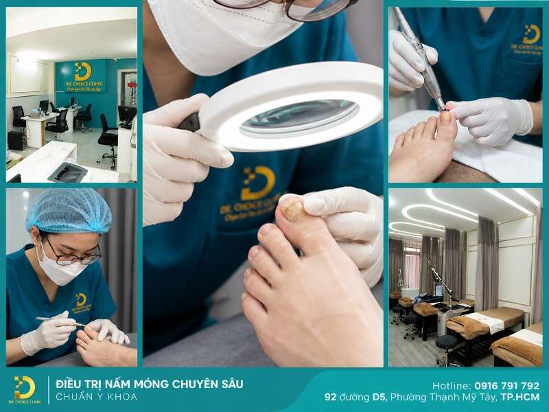 Phòng Khám Chữa Nấm Móng Uy Tín Hiệu Quả HCM 9 Phòng khám nào chữa nấm móng uy tín, hiệu quả tại Hồ Chí Minh?