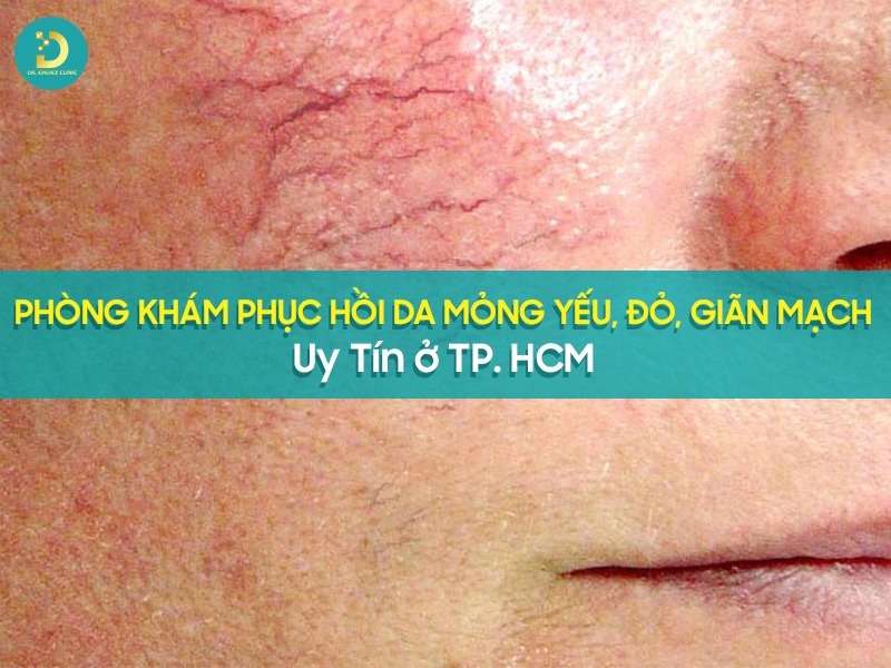Phòng Khám Phục Hồi Da Mỏng Yếu, Đỏ, Giãn Mạch Uy Tín TP. HCM 11 Phòng khám phục hồi da mỏng yếu, đỏ, giãn mạch