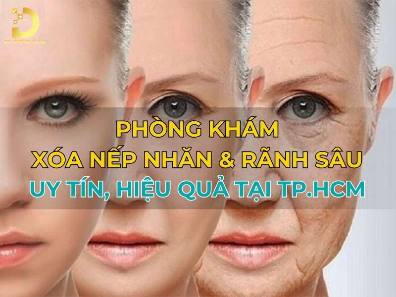 Phòng Khám Xóa Nếp Nhăn & Rãnh Sâu Uy Tín, Hiệu Quả Tại TP.HCM 8 Phòng khám xóa nếp nhăn & rãnh sâu uy tín